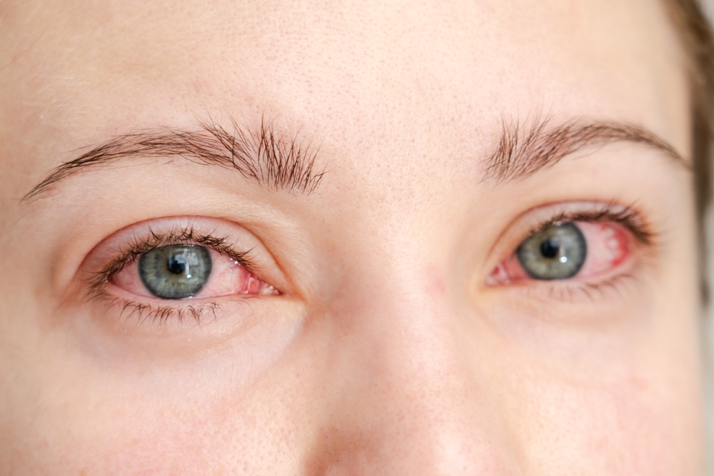 Ilustrační foto; Credit: Shutterstock