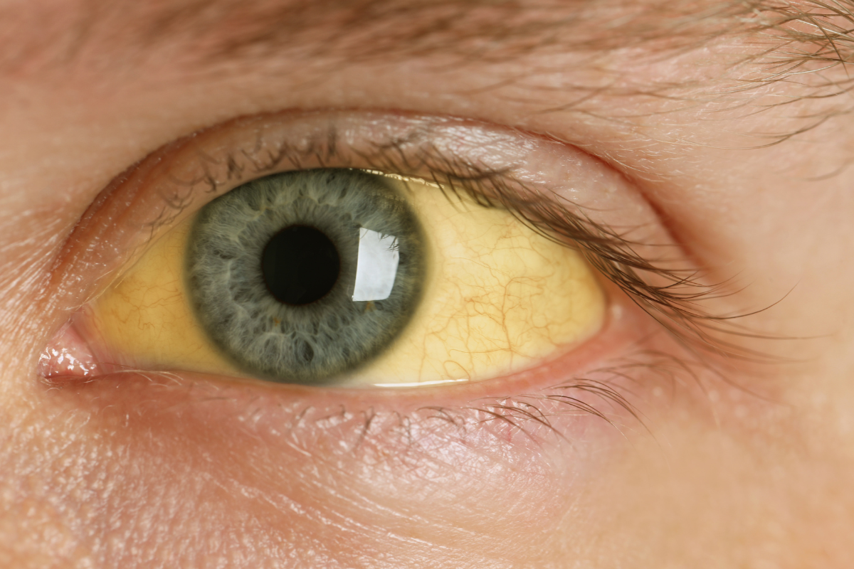 Ilustrační foto; Credit: Canva